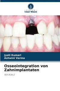 bokomslag Osseointegration von Zahnimplantaten