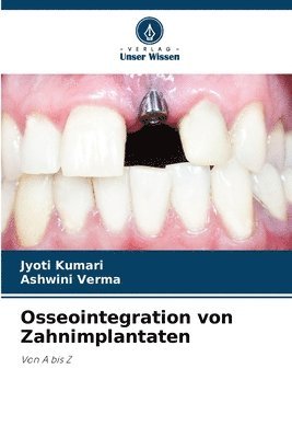 Osseointegration von Zahnimplantaten 1