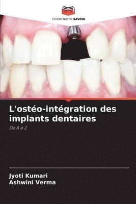 bokomslag L'osto-intgration des implants dentaires