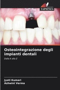 bokomslag Osteointegrazione degli impianti dentali