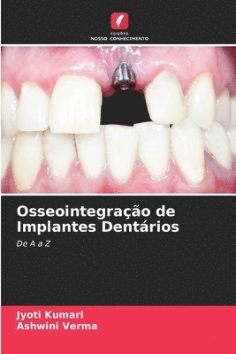 bokomslag Osseointegrao de Implantes Dentrios
