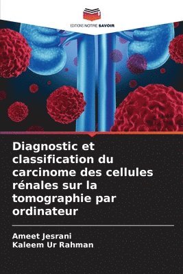 Diagnostic et classification du carcinome des cellules rnales sur la tomographie par ordinateur 1