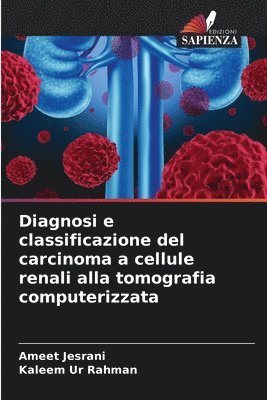 Diagnosi e classificazione del carcinoma a cellule renali alla tomografia computerizzata 1