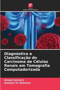 bokomslag Diagnstico e Classificao do Carcinoma de Clulas Renais em Tomografia Computadorizada