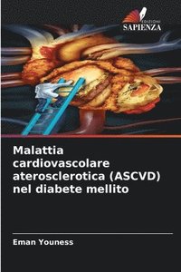 bokomslag Malattia cardiovascolare aterosclerotica (ASCVD) nel diabete mellito