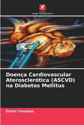 Doena Cardiovascular Aterosclertica (ASCVD) na Diabetes Mellitus 1