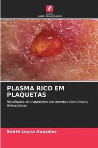 bokomslag Plasma Rico Em Plaquetas