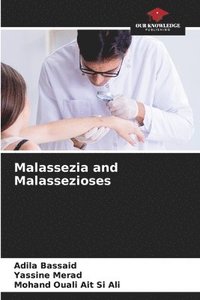 bokomslag Malassezia and Malassezioses