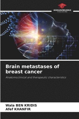 bokomslag Brain metastases of breast cancer