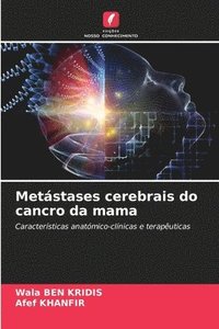 bokomslag Metstases cerebrais do cancro da mama