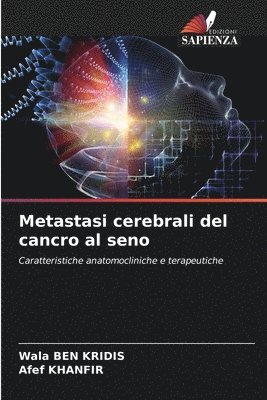 bokomslag Metastasi cerebrali del cancro al seno