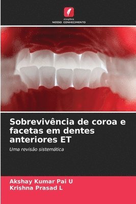 bokomslag Sobrevivncia de coroa e facetas em dentes anteriores ET