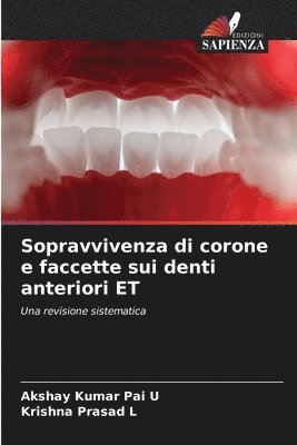 Sopravvivenza di corone e faccette sui denti anteriori ET 1