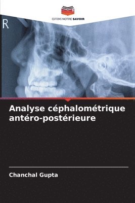 bokomslag Analyse céphalométrique antéro-postérieure