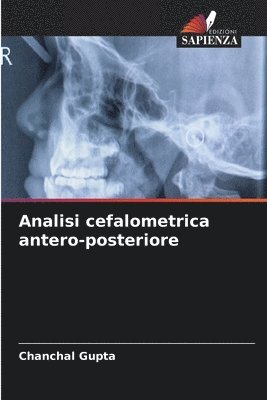 Analisi cefalometrica antero-posteriore 1