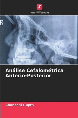 Anlise Cefalomtrica Anterio-Posterior 1