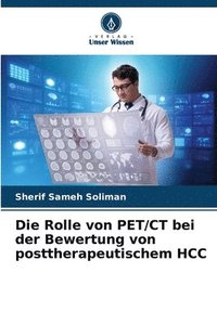bokomslag Die Rolle von PET/CT bei der Bewertung von posttherapeutischem HCC
