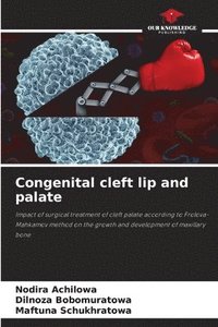 bokomslag Congenital cleft lip and palate