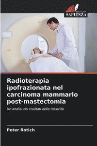 bokomslag Radioterapia ipofrazionata nel carcinoma mammario post-mastectomia
