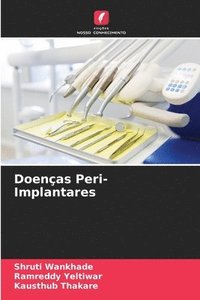 bokomslag Doenas Peri-Implantares