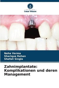 bokomslag Zahnimplantate