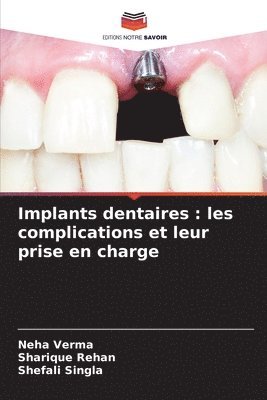 Implants dentaires 1