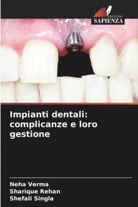 bokomslag Impianti dentali