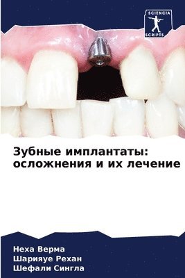 &#1047;&#1091;&#1073;&#1085;&#1099;&#1077; &#1080;&#1084;&#1087;&#1083;&#1072;&#1085;&#1090;&#1072;&#1090;&#1099; 1