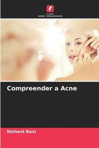 bokomslag Compreender a Acne