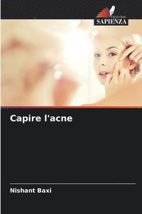 bokomslag Capire l'acne