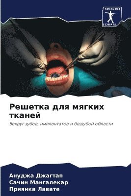 &#1056;&#1077;&#1096;&#1077;&#1090;&#1082;&#1072; &#1076;&#1083;&#1103; &#1084;&#1103;&#1075;&#1082;&#1080;&#1093; &#1090;&#1082;&#1072;&#1085;&#1077;&#1081; 1