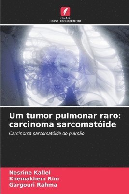 Um tumor pulmonar raro 1