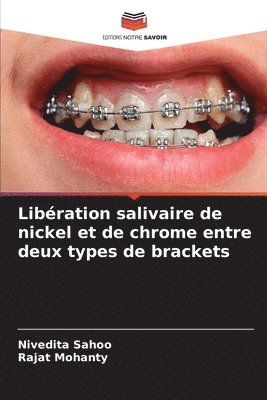 bokomslag Libration salivaire de nickel et de chrome entre deux types de brackets