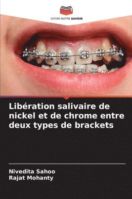Libration salivaire de nickel et de chrome entre deux types de brackets 1