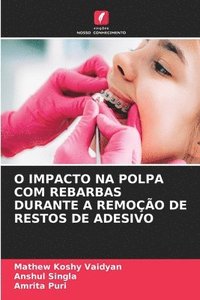 bokomslag O Impacto Na Polpa Com Rebarbas Durante a Remoo de Restos de Adesivo