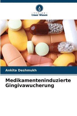 Medikamenteninduzierte Gingivawucherung 1