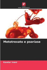 bokomslag Metotrexato e psorase