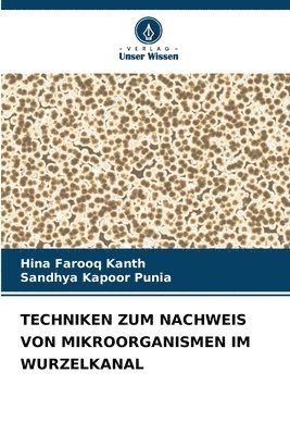 Techniken Zum Nachweis Von Mikroorganismen Im Wurzelkanal 1