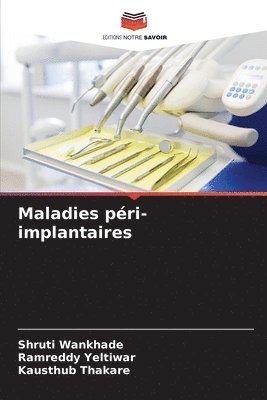 Maladies pri-implantaires 1