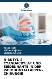 bokomslag N-Butyl-2-Cyanoacrylat Und Seidennhte in Der Parodontallappen-Chirurgie