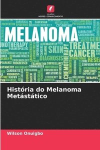 bokomslag Histria do Melanoma Metsttico