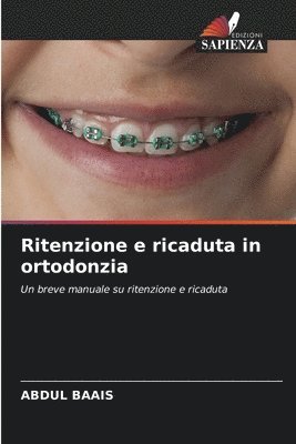 Ritenzione e ricaduta in ortodonzia 1