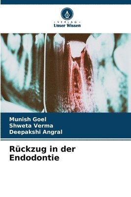 bokomslag Rckzug in der Endodontie