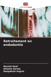 bokomslag Retraitement en endodontie