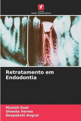 Retratamento em Endodontia 1