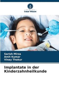 bokomslag Implantate in der Kinderzahnheilkunde
