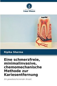 bokomslag Eine schmerzfreie, minimalinvasive, chemomechanische Methode zur Kariesentfernung