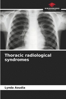 Thoracic radiological syndromes 1