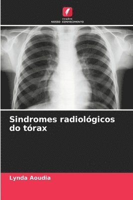Sindromes radiologicos do torax 1