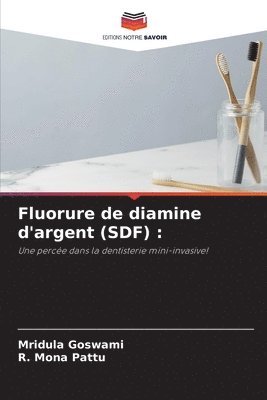 Fluorure de diamine d'argent (SDF) 1